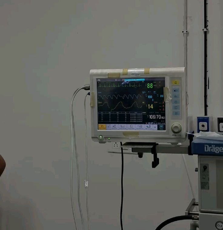 Equipamento de eletrocardiograma em ambiente clínico — imagem ilustrativa