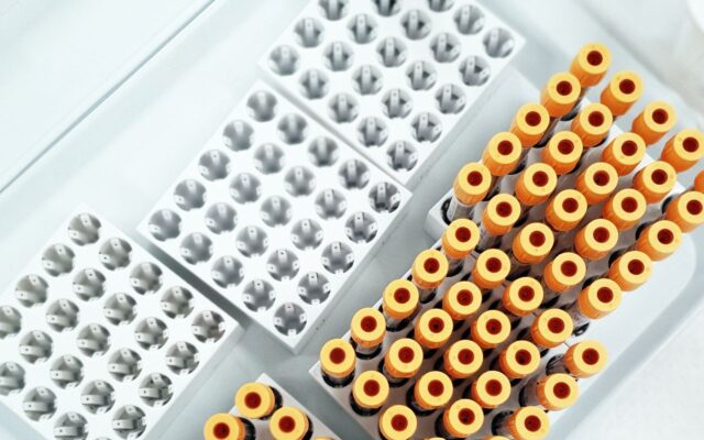 Tubos com amostras de sangue vistos de cima em ambiente de laboratório